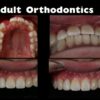 DentalXP Adult Orthodontics.jpg