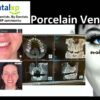 DentalXP Porcelain Veneers.jpg