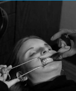 Digital Dental Photography