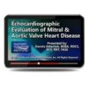 Echocardiographic Evaluation of Mitral and Aortic Valve Heart Disease.jpg