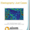 Elastography Just Cases.jpg