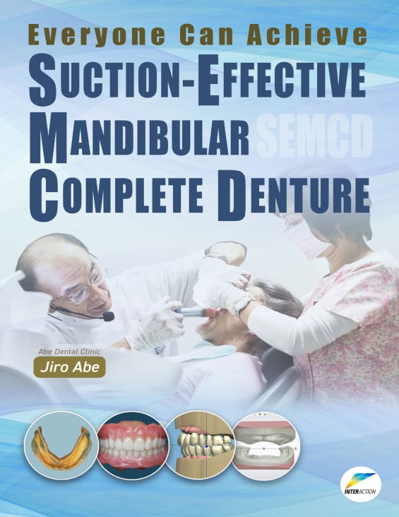 Everyone Can Achieve SUCTION-EFFECTIVE MANDIBULAR COMPLETE DENTURE PDF