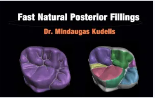 Fast Natural Posterior Fillings
