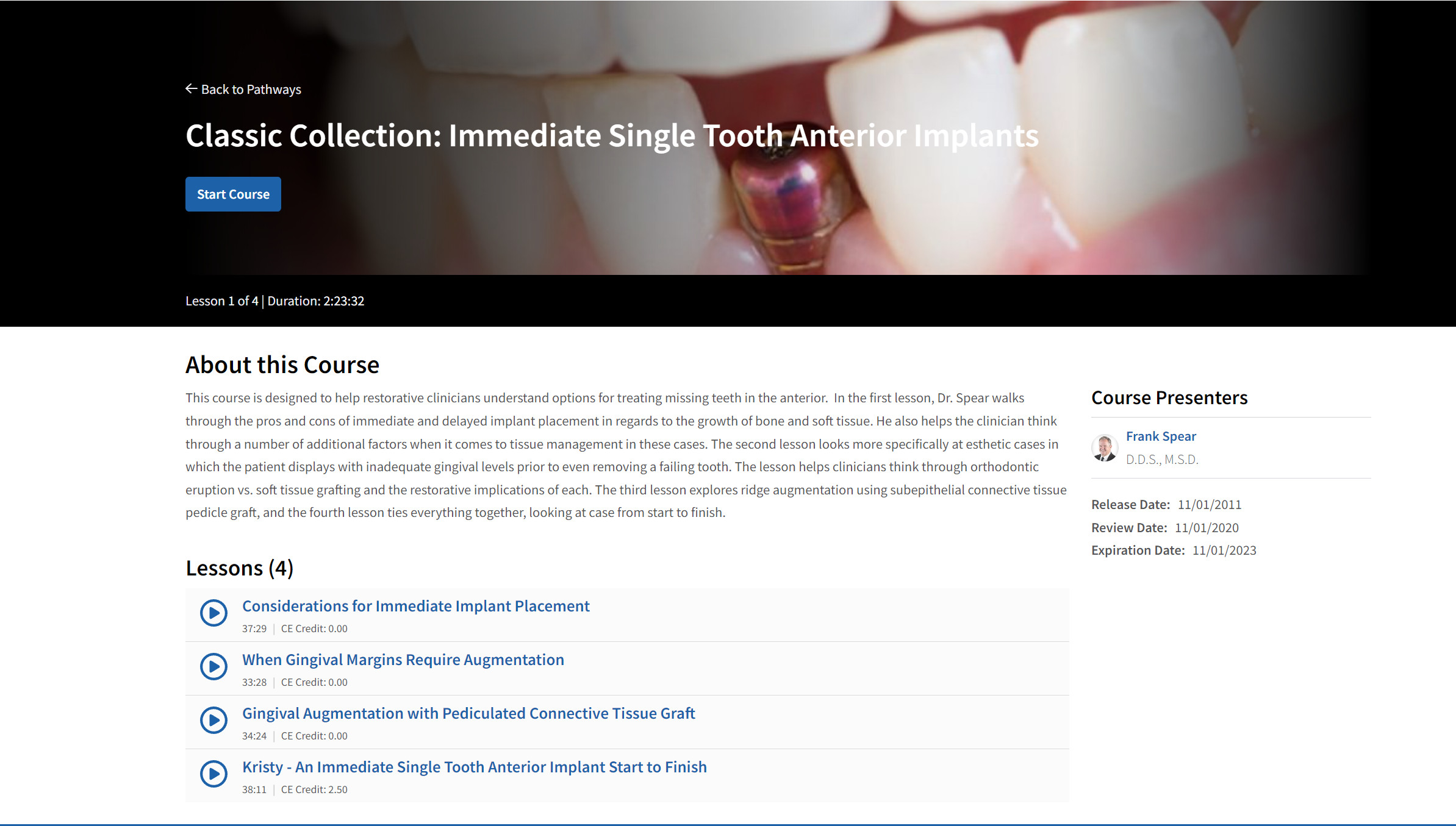 Classic Collection: Immediate Single Tooth Anterior Implants