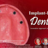 Implant Retained Dentures 2.jpg