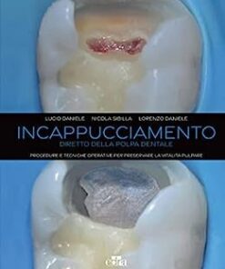 Incappucciamento diretto della polpa dentale: Procedure e tecniche operative per preservare la vitalità pulpare / Lucio Daniele, Nicola Sibilla, Lorenzo Daniele (2023)