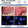 Journal of Oral Pathology Medicine 2022.jpg