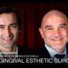 Mucogingival Esthetic Surgery.jpg