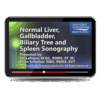 Normal Liver Gallbladder Biliary Tree and Spleen Sonography.png