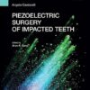 Piezoelectric Surgery of Impacted Teeth.jpg