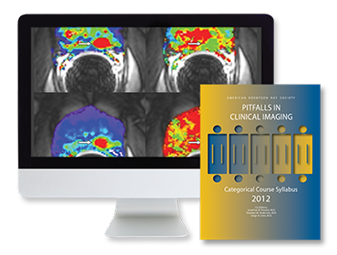 Pitfalls in Clinical Imaging