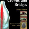 Planning and Making Crowns and Bridges 4th ed.jpg