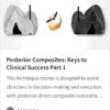 Posterior Composites.jpg