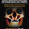 Remote Anchorage Solutions for Severe Maxillary Atrophy.jpg