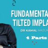 RipeGlobal Fundamentals in Tilted Implants.jpg