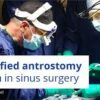 Simplified antrostomy design in sinus surgery.jpg