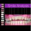 Smile Analysis.jpg