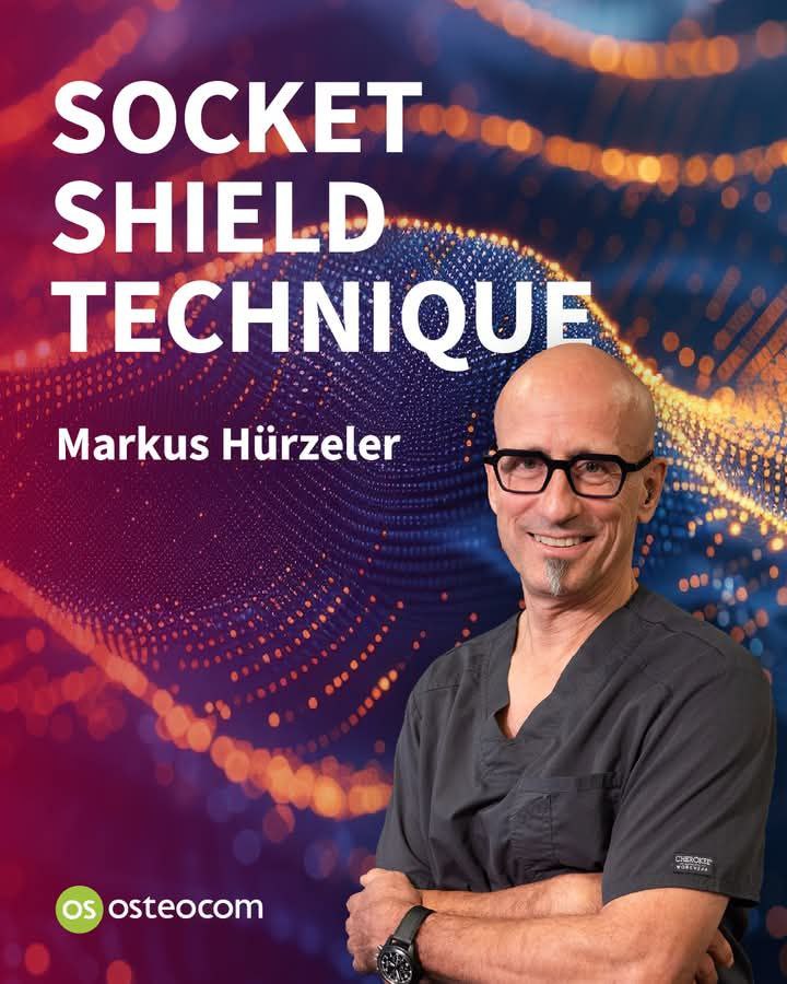 osteocom Socket Shield Technique 2025