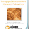 Sonographic Evaluation of the Uterus and Endometrium.jpg