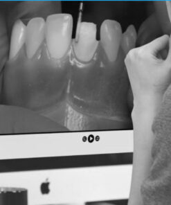 The Esthetic Post and Core