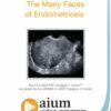The Many Faces of Endometriosis.jpg