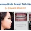 The Photoshop Smile Design Technique.webp