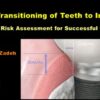 Transitioning of Teeth to Implants.jpg