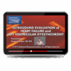 Ultrasound Evaluation of Heart Failure and Left Ventricular Dyssynchrony.png