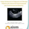 Using Ultrasound to Diagnose and Manage Patients with Abnormal Premenopausal and Postmenopausal Bleeding.jpg