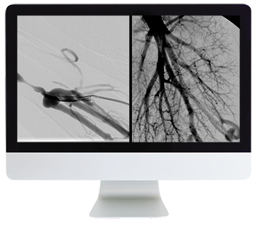 Vascular and Interventional Radiology