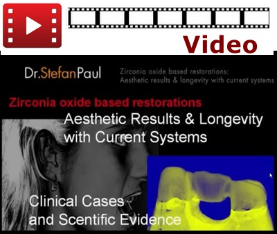 Zirconia Oxide Based Restorations: Aesthetic Results & Longevity with Current Systems