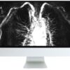 Arrs advanced chest imaging 2019 medical video courses 217836 540x 1.jpg