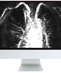 ARRS Advanced Chest Imaging 2019