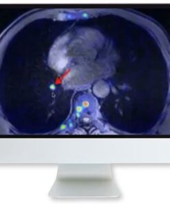 ARRS Applying Recent Advances in PET to Clinical Practice 2020