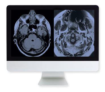 ARRS Artifacts and Physics in Daily Imaging A Case-Based Approach Online Course 2015