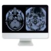 Arrs artifacts physics in daily imaging a case based approach medical video courses 527604 540x.jpg