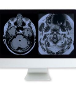  ARRS artifacts & physics in Daily imaging - A case-based Approach