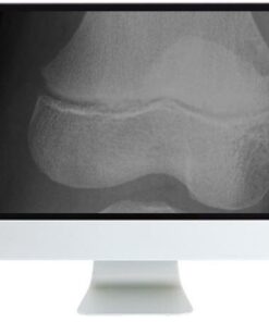 ARRS Clinical Case-Based Review of Musculoskeletal Imaging 2019