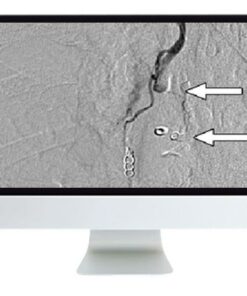 ARRS Clinical Case-Based Review of Vascular and Interventional Imaging 2019