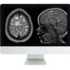 Arrs clinical pediatric imaging review 2017 medical video courses 223983 360x.jpg