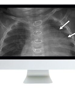 ARRS Clinical Pediatric Imaging Review 2019