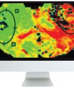 ARRS Code Stroke: What the Radiologist Needs to Know in the Changing Landscape of Acute Ischemic Stroke 2019