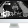 Arrs cross sectional renal imaging techniques and diagnosis 2020 medical video courses 852471 720x.jpg