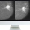 Arrs harmonizing breast cancer screening recommendations hybrid course 2018 medical video courses 619322 720x 1.jpg