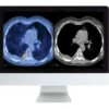 Arrs practical petct what you need to know medical video courses 605700 360x 2.jpg
