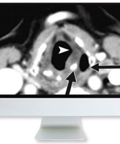 ARRS Thyroid Cancer Therapy: Go High, Go Low, or Go Home 2020