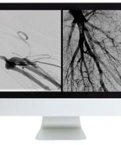 ARRS Vascular and Interventional Radiology Review 2016