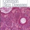 Common skin diseases 18th 230x3001 1 176x230 1.jpg