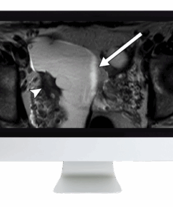 ARRS Women’s Imaging 2019 (CME VIDEOS)