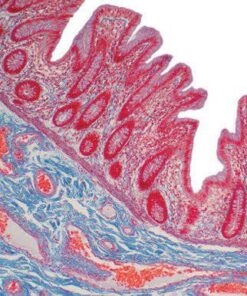Current Topics in Gastrointestinal and Liver Pathology 2022 CME VIDEOS